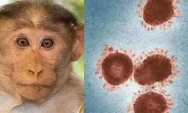 出现女性猴痘感染者意味着什么 的图像结果
