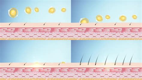 设置与毛发生长的干细胞治疗的矢量图解插画图片下载-正版图片402409335-摄图网