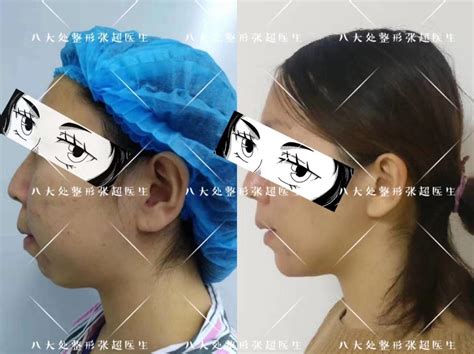 女性面部做整容整形手术元素素材下载-正版素材401778515-摄图网