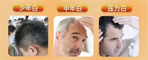 叶酸片白发中老年白头发男士补黑发维生素b6治正品可批发代发-阿里巴巴