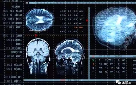 3分钟带你读懂AI+MRI影像诊断全过程|影像|病灶|磁共振_新浪新闻