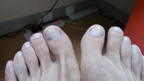 【图】脚指甲有黑点图片欣赏 从指甲的变化来判断疾病_脚指甲有黑点图片_伊秀美容网|yxlady.com