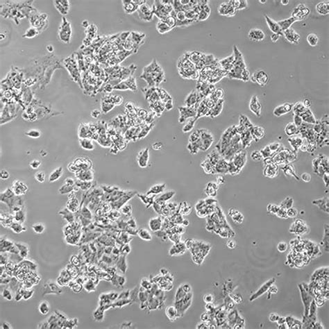 NK92MI细胞（人恶性非霍奇金淋巴瘤患者的自然杀伤细胞）培养注意事项-上海传秋生物科技有限公司