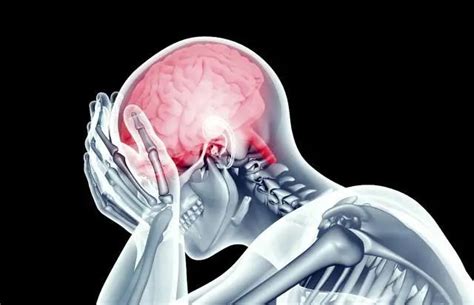 神经性头疼怎么引起的-六六健康网