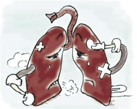 到了肺癌中晚期，患者能活多久？