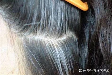 白头发长得位置示意图 白发位置揭露不同内脏问题_美发护发 - 美发站