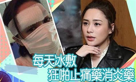 阿娇伤口6天后拆线 经纪公司：希望疤痕不大