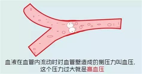 中国高血压健康管理规范（2019） - 知乎