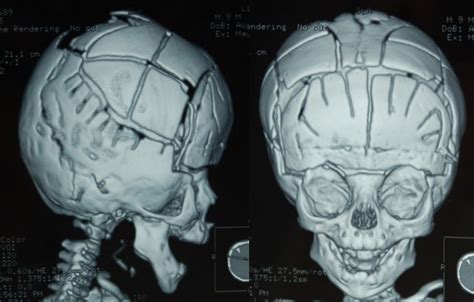 人体骨骼素材PSD免费下载_红动中国