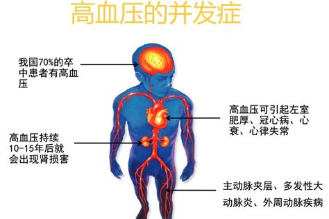 继发性高血压【多图】_39医疗图集-39健康网