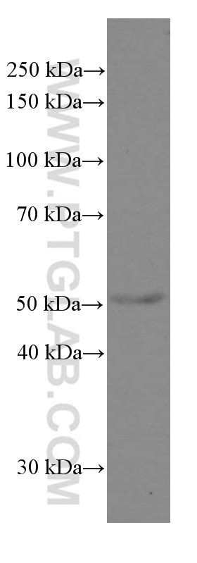 Cytokeratin 5 antibody (66727-1-Ig) | Proteintech | 武汉三鹰生物技术有限公司