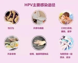 HPV感染 - 搜狗百科