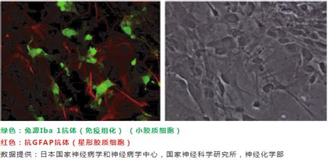 FUJIFILM wako丨神经系统小胶质细胞标记物—Iba1抗体 - 北京拜尔迪生物技术有限公司