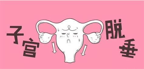 子宫脱垂的有哪些症状 如何预防子宫脱垂 _八宝网