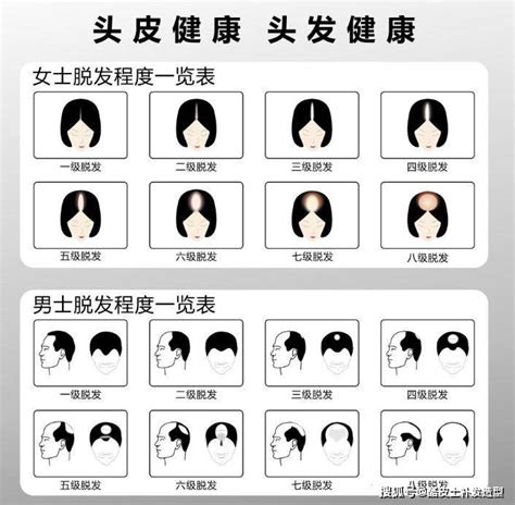 发缝正常图片,头发缝正常状态图片,发缝_大山谷图库