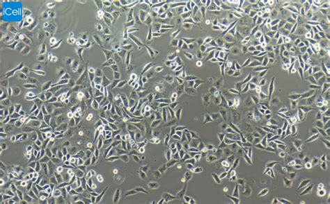 T24 人膀胱癌细胞-原代细胞-STR细胞-细胞培养基-赛百慷生物