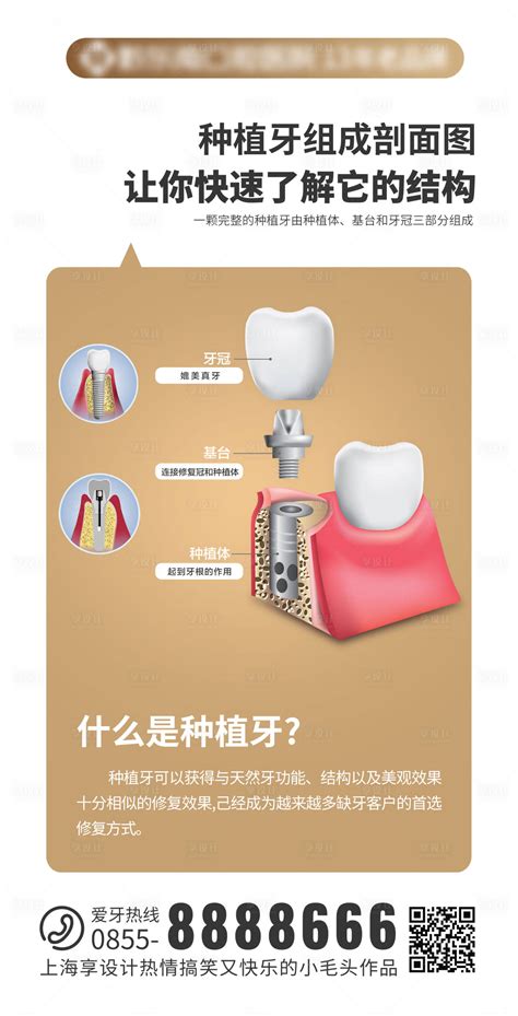 种植牙手术知识详细步骤ppt模版_PPT牛模板网