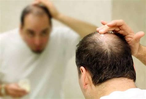 科学研究：衰老细胞或许能促进头发再生-36氪