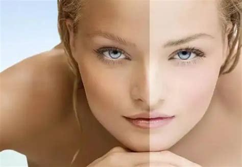 哪种护肤品能有效改善肤色暗黄，淡化斑点？ - 知乎