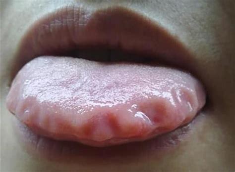 【为什么舌头上有红点点】【图】为什么舌头上有红点点呢 3种原因可造成舌上红点_伊秀健康|yxlady.com