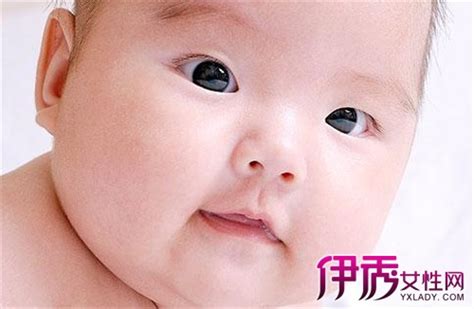 小儿肛裂图片