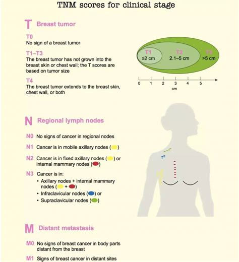 乳腺癌有哪些主要的转移途径？ - 微医（挂号网）
