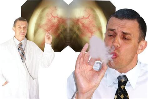 除了吸烟，还有哪些因素会增加患肺癌的几率? - 知乎