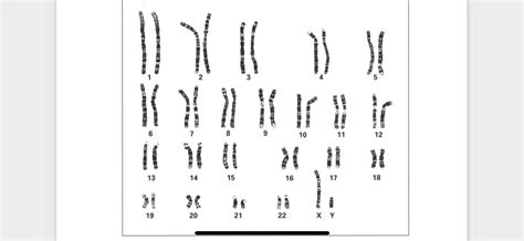 关于人类染色体核型报告解读及相关案例简述 | LRC