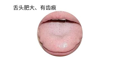 正常舌头的图片