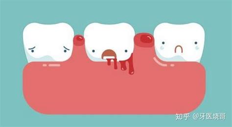 牙齿松动出血萎缩修复牙周炎发炎清洁护理固齿专用牙膏牙神器牙膏-淘宝网