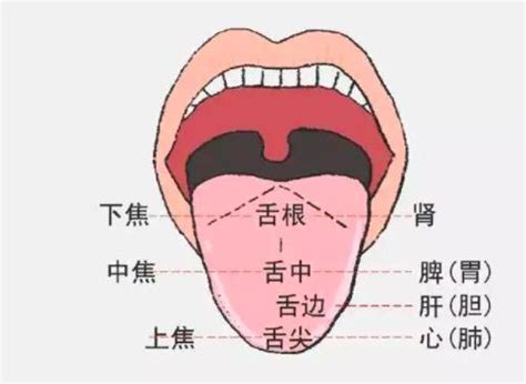 舌象分析图片