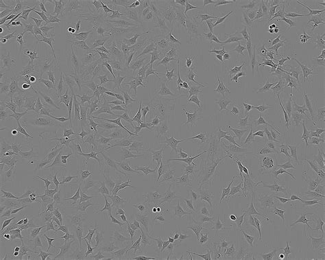 ATDC5细胞 小鼠胚胎瘤细胞株购买价格、培养基、培养条件、细胞图片、特征等基本信息_生物风