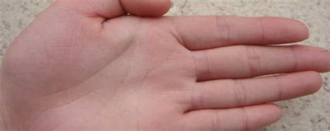 聚财纹：小指和无名指下方出现这种竖纹_腾讯视频