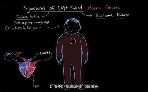 【心衰国际学院】陈礼平教授：心衰患者的容量管理-从最新指南到临床实践_心力衰竭和心肌病网
