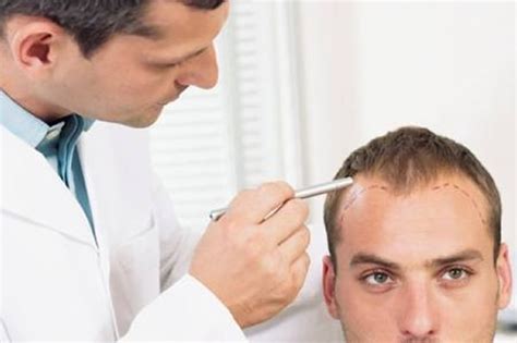 皮肤镜能不能确诊雄激素型脱发？ - 知乎