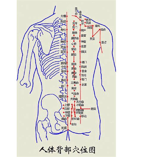 人体背部拔罐图图片
