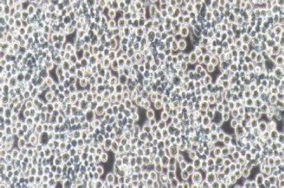 Sp2/O-Ag14 小鼠骨髓瘤细胞-原代细胞-STR细胞-细胞培养基-赛百慷生物