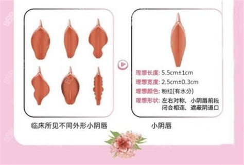 正常阴唇图片