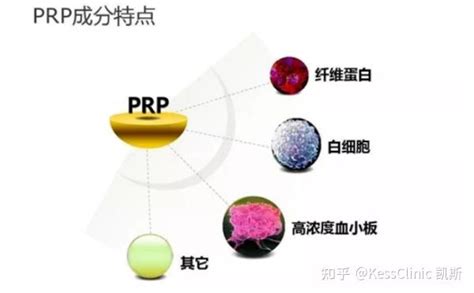 富血小板血浆（PRP）真的有效_四川威格科技有限公司_四川众益达商贸有限公司_PRP富血小板血浆提取系统