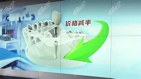 广州番禺区牙科医院好又便宜的是这家,半口种植牙收费1w多 - 口腔优惠 - 牙齿矫正网