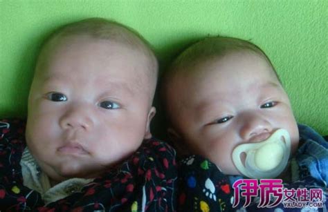 全世界唯一的双胞胎，前后出生相差3个月 - 360娱乐，你开心就好