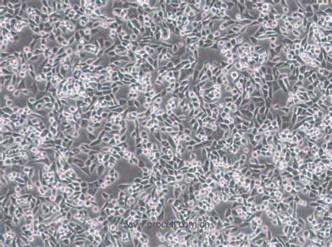 4T1 小鼠乳腺癌细胞-原代细胞-STR细胞-细胞培养基-镜像绮点生物