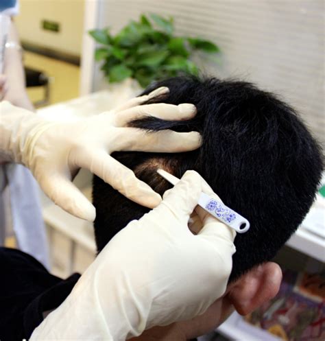 头发皮肤检测仪 面部头发皮肤检测仪 美容院高清面部皮肤检测仪器-阿里巴巴
