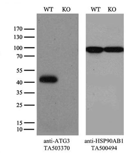 Structural basis of ATG3 recognition by the autophagic ubiquitin-like ...
