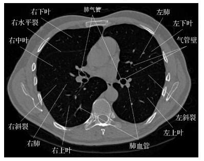 早期肺癌信号怎么查？医生说最好定期做肺部CT检查 - 知乎