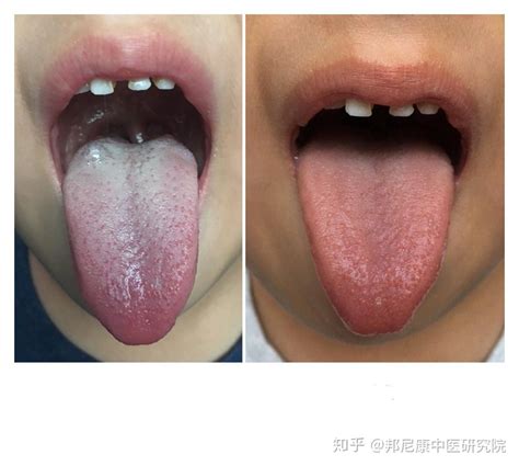 观舌识病:22种舌诊图解大全，通过舌头认识自己的身体状况_【快资讯】