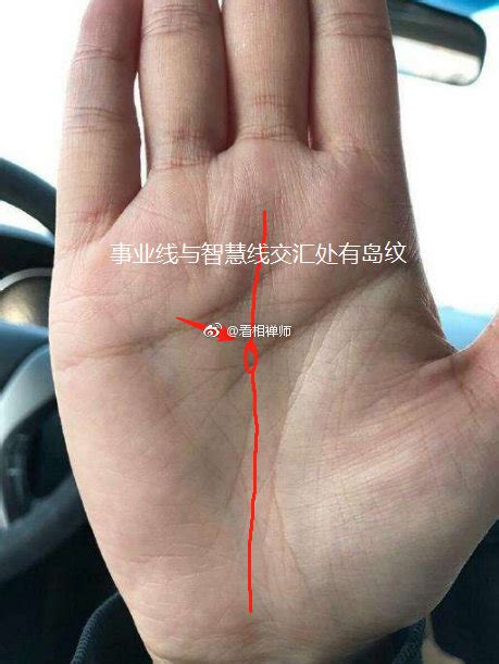 事业线图解图片