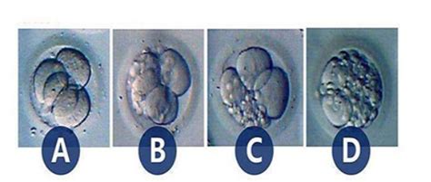 到底是什么影响了试管胚胎的质量-深圳中山泌尿外科医院