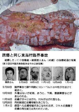 日本东海村核临界事故图册_360百科