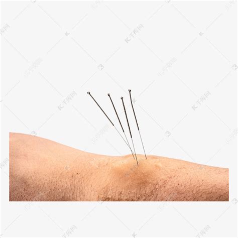 针灸穴位图图片